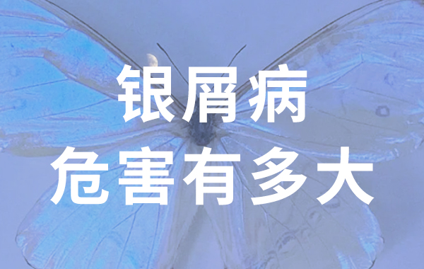 銀屑病危害到底有(yǒu)多(duō)大